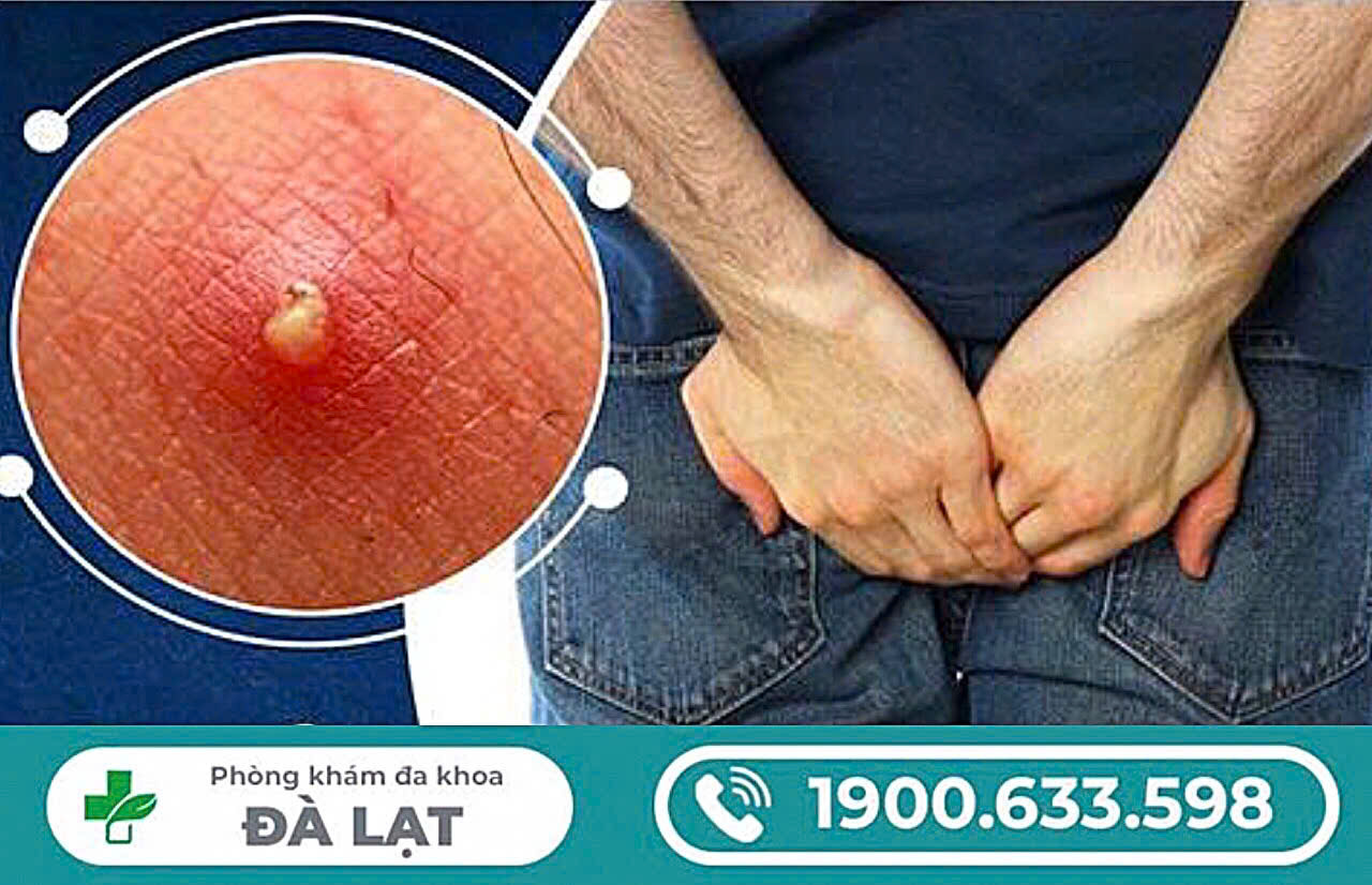 Hình ảnh minh họa